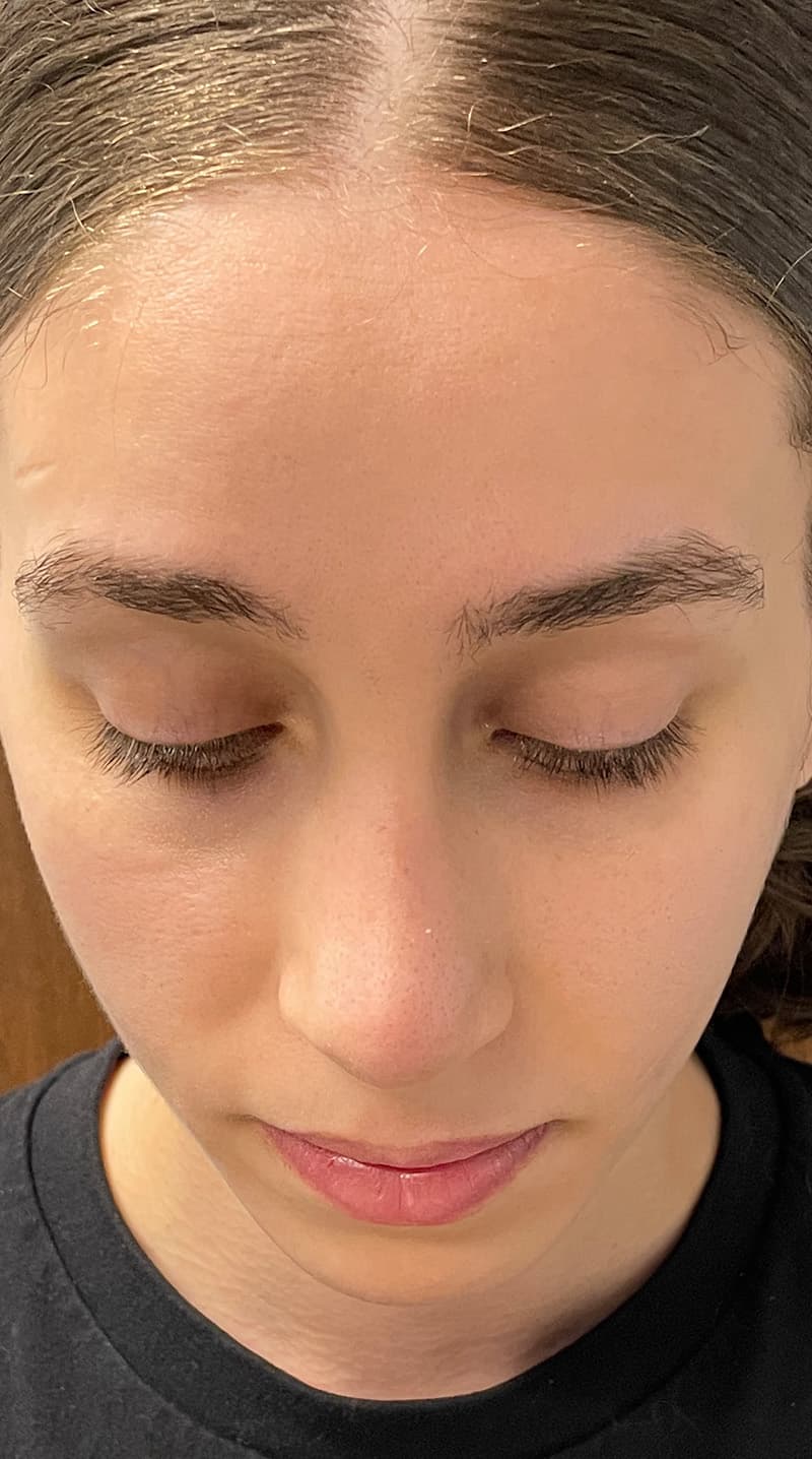 rhinoplasty after, patient 122833306, Dr. Shari Reitzen, New York