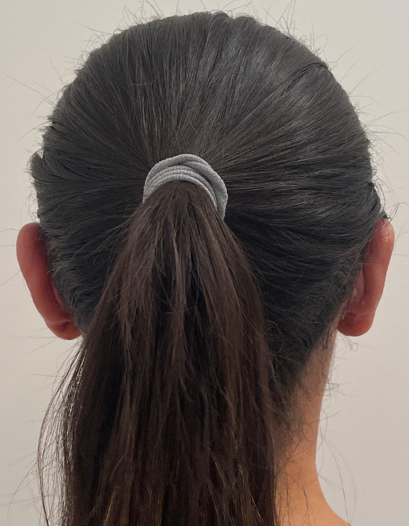 otoplasty after, patient 141547530, Dr. Shari Reitzen, New York